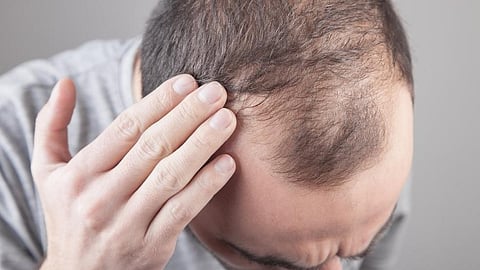 Representational image.