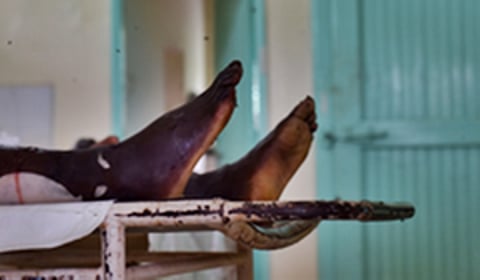 Image used for representational purposes.