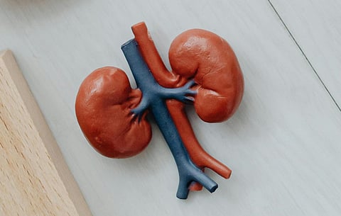 Representative picture of kidneys