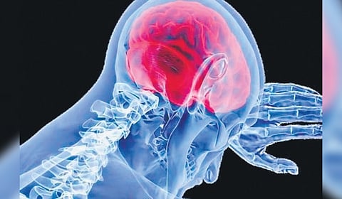 According to the World Health Organisation (WHO), meningitis is the inflammation of the tissues surrounding the brain and spinal cord.