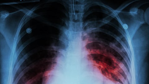 Image used for representational purpose.