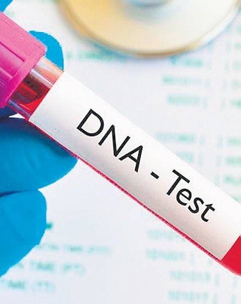 Image used for representational purposes