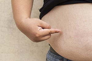 Tackling obesity and malnutrition head-on