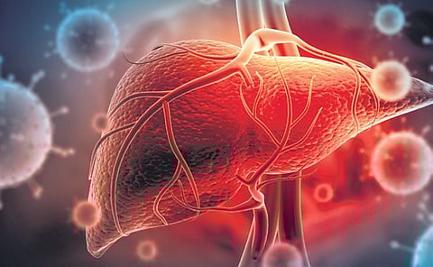 OPDs full with Hepatitis A, E cases as monsoon picks pace
