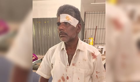 Marimuthu, a mic set operator was attacked by members of dominant community in Palani.