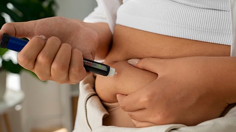 Representative Image