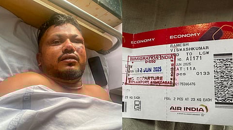 ViswashKumar Ramesh, the lone survivor of the Air India plane crash, receives treatment at a hospital in Ahmedabad.