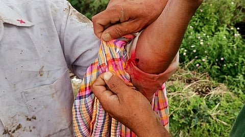 In fresh violence in Manipur, a Kuki woman was shot dead while a Meitei farmer sustained bullet wounds.