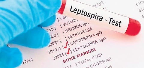 The disease is spread by leptospira, a bacteria present in the urine of several animals.