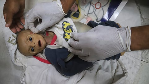A morgue worker prepares the body of 5-month-old baby Zainab Abu Halib, who died from malnutrition-related causes, according to Dr. Ahmed al-Farah, head of the pediatric department at Nasser Hospital, before her funeral in Khan Younis, Gaza Strip, Saturday, July 26, 2025.