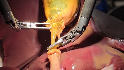 A robot guided by AI performing a surgery.