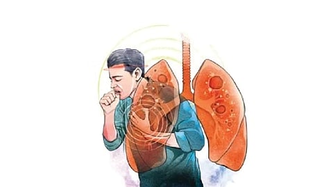 Image used for representational purpose.