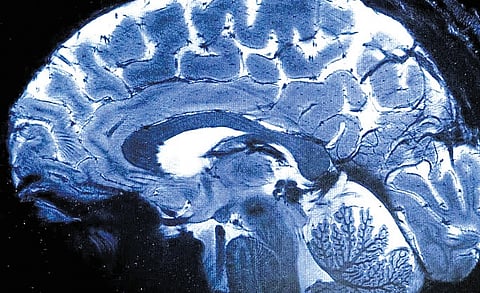 Medical experts warn that the recent surge may be linked to different types of amoeba, including Naegleria fowleri, Acanthamoeba, Sappinia, and Balamuthia, all of which are known to cause severe brain infections.