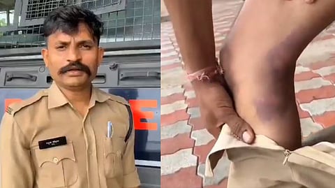 A video later surfaced showing the constable displaying visible injury marks.