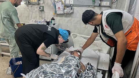 American nurse Andee Vaughan, second from left, attending to a child suffering from severe burns after an Israeli army strike on his house, at the Al-Quds Hospital in Gaza City on July 24, 2025.