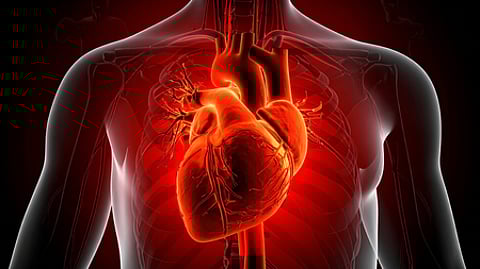 Representative image