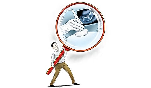 The accused allegedly sold them to individuals in Theni and Salem districts.