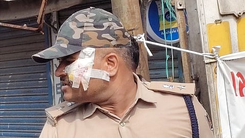 The injured DCP Khilari Rishikesh Dnyandeo