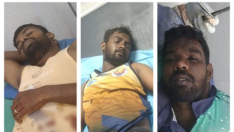 Injured Indian fishermen
