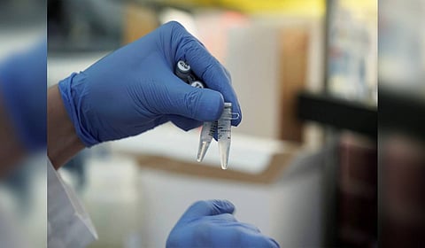 Representative Image