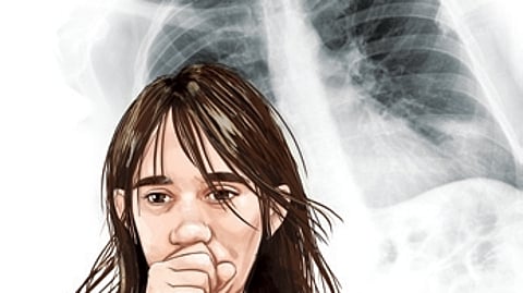 Image used for representative purpose.