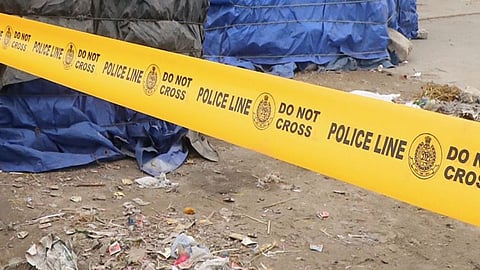 Representative image