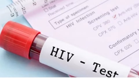 Fall in HIV cases doesn’t show whole
picture: Bengaluru docs