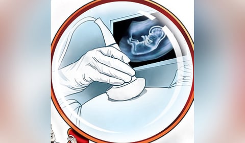 Representative Image