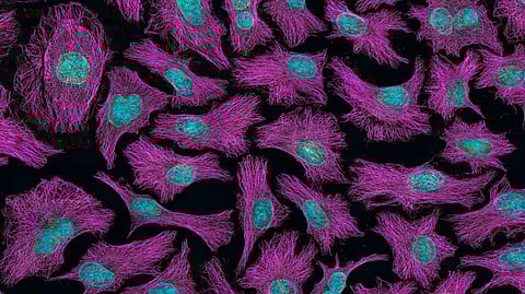 What’s the difference between a tumour and cancer?