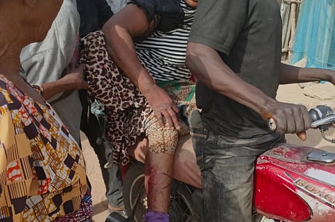 People help an injured woman that was caught in an army crossfire after a communal clash in Lamurde, northeastern Nigeria, Monday, Dec. 8, 2025.
