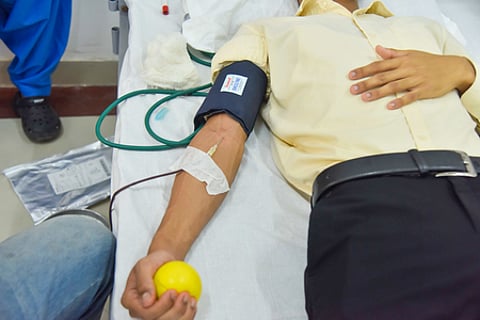 Representative image