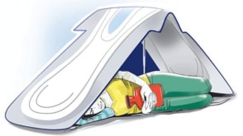 Representative image