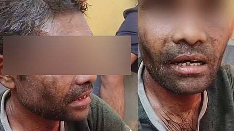 Ramnarayan Bhayar was lynched on false theft charge, abandoned for hours: Autopsy confirms Bhayar died of severe assault; five held, SHRC seeks report