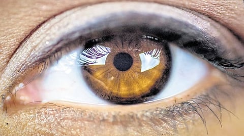 Representative Image