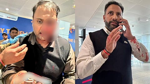 The injured passenger Ankit Dewan (L), Captain Virendra Sejwal (R)