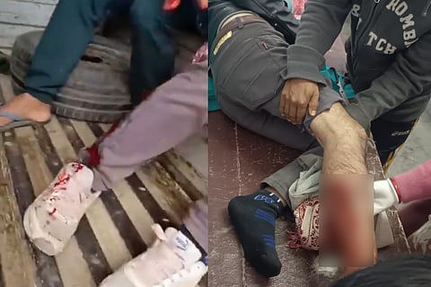 Two persons, identified as Sanatomba Singh and Indubala Devi, sustained splinter injuries on their right legs.