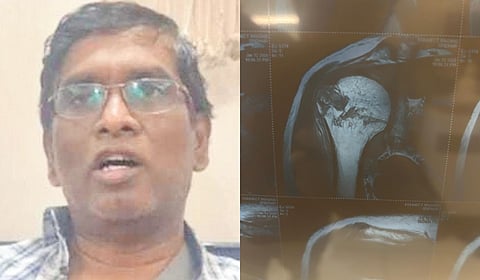 Mudooru told TNIE that he has suffered a severe fracture and doctors have told him to undergo a surgery costing over Rs 1.25 lakh.