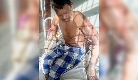 Injured victim Bidyadhar Majhi.