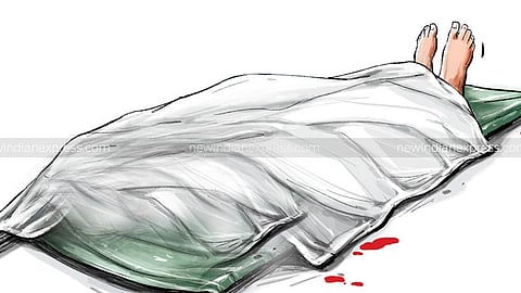 Representative Image