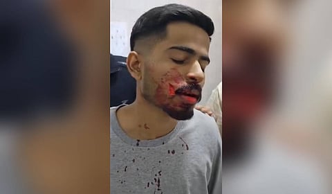 Critically injured student Gaurav, a native of Maharashtra.