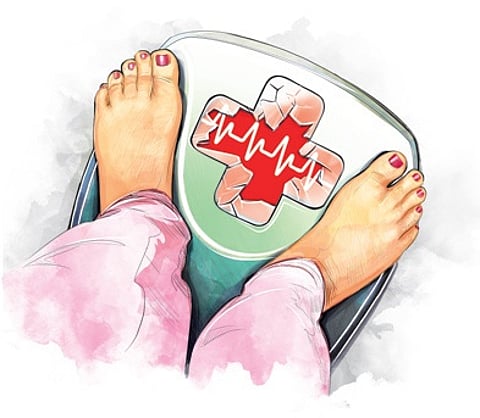 Representative image