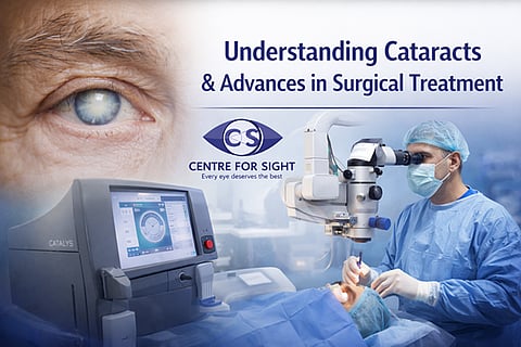 Understanding Cataracts and Advances in Surgical Treatment