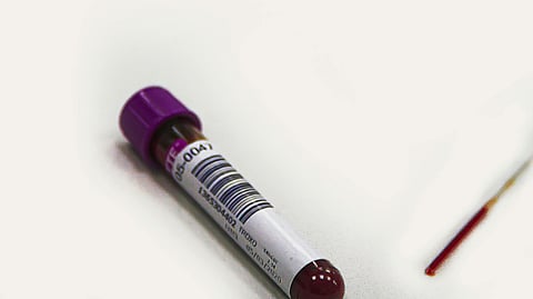 Moreover, over 80% of respondents were unaware that blood in stool can be an early warning sign of colorectal cancer.