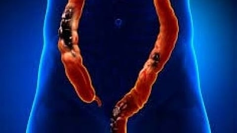 Image used for representation