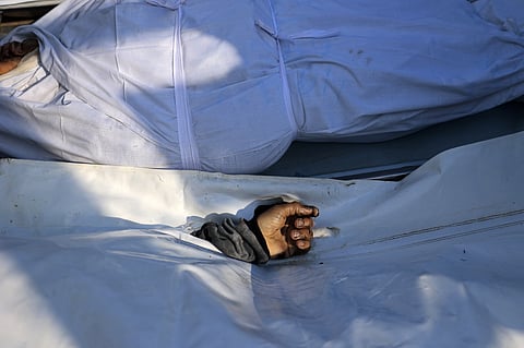 The hand of a Palestinian, who according to medics was killed in an overnight Israeli strike, is seen before his funeral in Deir el-Balah, central Gaza Strip on April 11, 2026.