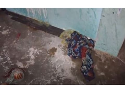 Delhi: Bride-to-be critical after acid attack, accused woman arrested