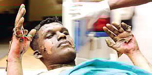 Youth in love dies of burns