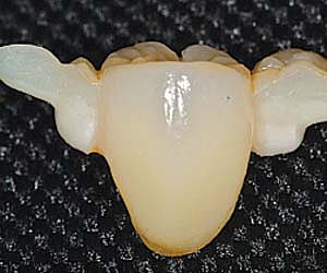 Get that dazzling smile