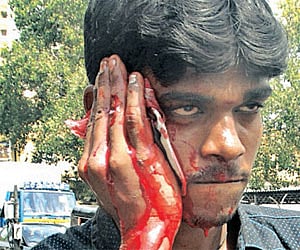 Suresh, a student of BA (IInd year) of Pachaiyappa’s college who sustained injury on his face in a group clash in the city on Thursday; and the weapon