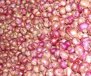 Representative image.